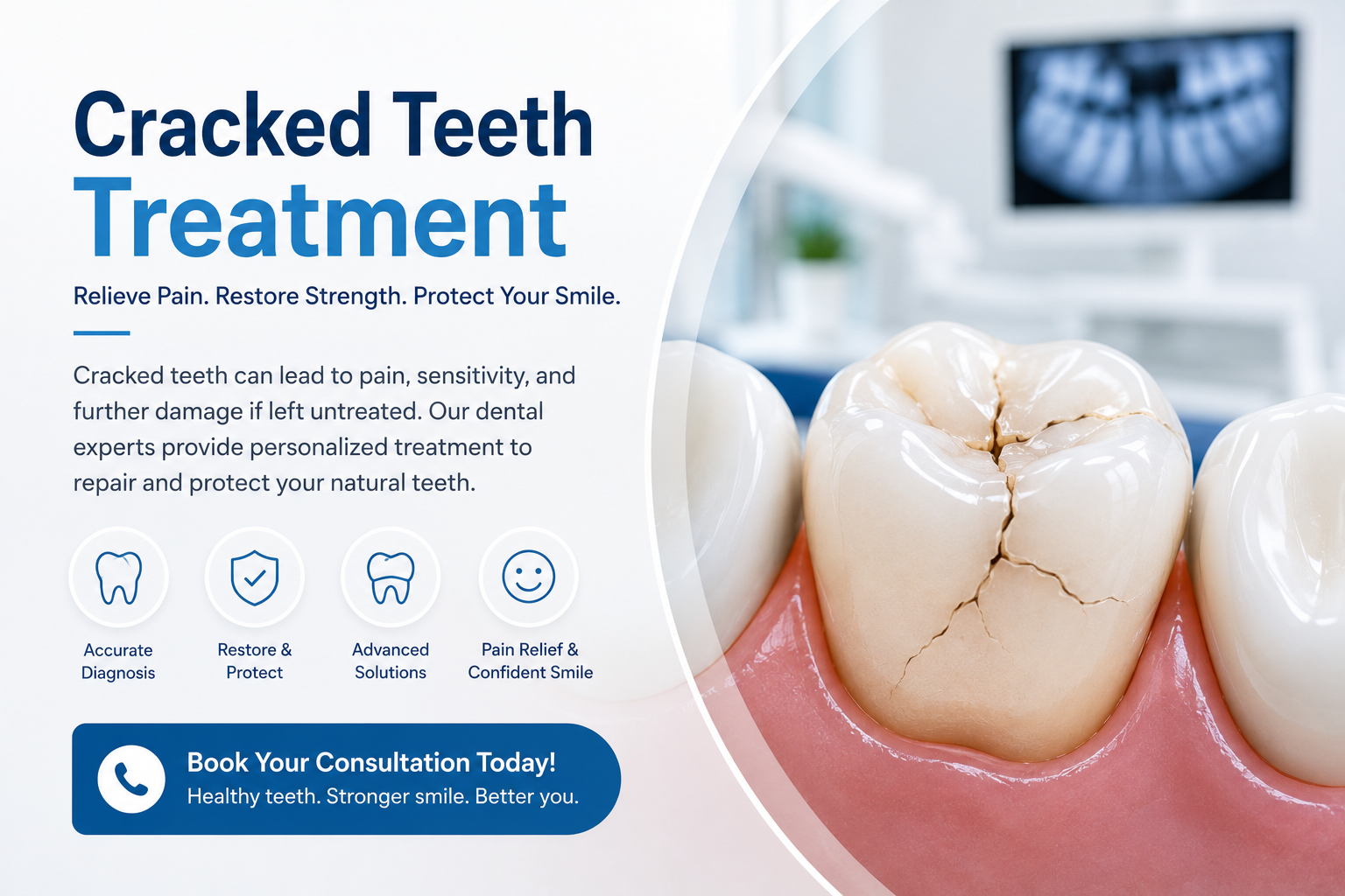 Cracked Teeth Treatment in New Westminster